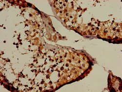 Invitrogen NUP107 Polyclonal Antibody 100 &mu;g; Unconjugated:Antibodies,