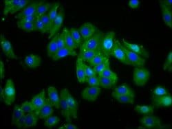 Invitrogen Opsin Green Polyclonal Antibody 100 &mu;g; Unconjugated:Antibodies,