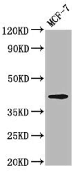 Invitrogen Opsin Green Polyclonal Antibody 100 &mu;g; Unconjugated:Antibodies,