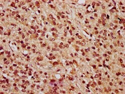Invitrogen PARP3 Polyclonal Antibody 100 &mu;g; Unconjugated:Antibodies,