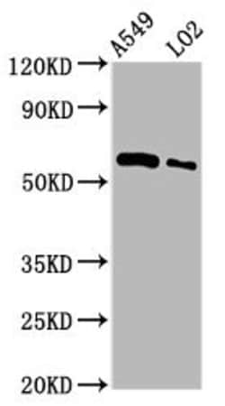 Invitrogen PARP3 Polyclonal Antibody 100 &mu;g; Unconjugated:Antibodies,