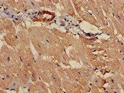 Invitrogen PCCA Polyclonal Antibody 100 &mu;g; Unconjugated:Antibodies,