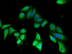 Invitrogen PDE2A Polyclonal Antibody 100 &mu;g; Unconjugated:Antibodies,
