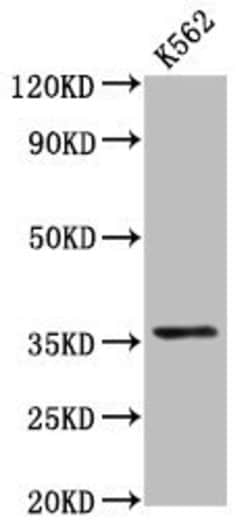 Invitrogen PDLIM4 Polyclonal Antibody 100 &mu;g; Unconjugated:Antibodies,