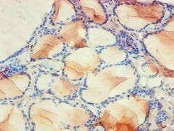 Invitrogen PDPK1 Polyclonal Antibody 100 &mu;L; Unconjugated:Antibodies,
