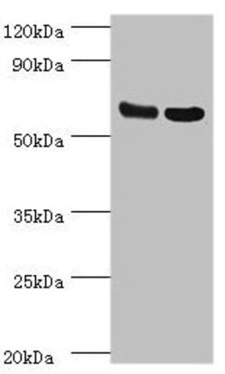 Invitrogen PDPK1 Polyclonal Antibody 100 &mu;L; Unconjugated:Antibodies,