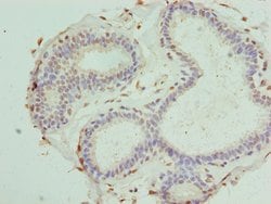 PDXK Polyclonal Antibody:Antibodies, Polyclonal