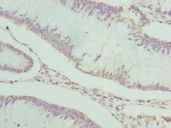 PDXK Polyclonal Antibody:Antibodies, Polyclonal