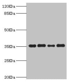 PDXK Polyclonal Antibody:Antibodies, Polyclonal
