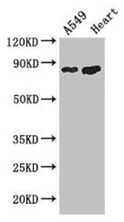 Invitrogen PFKM Polyclonal Antibody 100 &mu;g; Unconjugated:Antibodies,