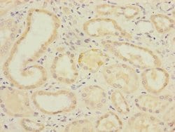 Invitrogen PGAM2 Polyclonal Antibody 100 &mu;L; Unconjugated:Antibodies,