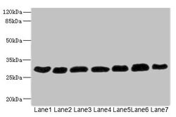 Invitrogen PGAM2 Polyclonal Antibody 100 &mu;L; Unconjugated:Antibodies,