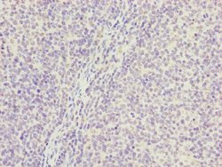 Invitrogen PGLS Polyclonal Antibody 100 &mu;L | Buy Online | Invitrogen&trade; | Fisher Scientific