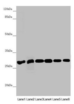 Invitrogen PGLS Polyclonal Antibody 100 &mu;L | Buy Online | Invitrogen&trade; | Fisher Scientific