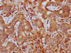 Invitrogen PHACTR1 Polyclonal Antibody 100 &mu;g | Buy Online | Invitrogen&trade; | Fisher Scientific