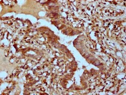 Invitrogen PHACTR1 Polyclonal Antibody 100 &mu;g | Buy Online | Invitrogen&trade; | Fisher Scientific