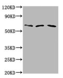 Invitrogen PHACTR1 Polyclonal Antibody 100 &mu;g | Buy Online | Invitrogen&trade; | Fisher Scientific