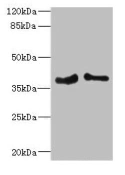 Invitrogen PHF11 Polyclonal Antibody 100 &mu;L; Unconjugated:Antibodies,