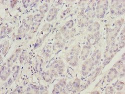 Invitrogen PHKG2 Polyclonal Antibody 100 &mu;L; Unconjugated:Antibodies,