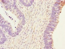 Invitrogen PHKG2 Polyclonal Antibody 100 &mu;L; Unconjugated:Antibodies,