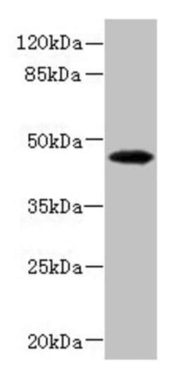 Invitrogen PHKG2 Polyclonal Antibody 100 &mu;L; Unconjugated:Antibodies,