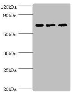 Invitrogen PIAS2 Polyclonal Antibody 100 &mu;L; Unconjugated:Antibodies,