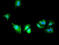 Invitrogen PLS3 Polyclonal Antibody 100 &mu;g; Unconjugated:Antibodies,