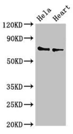 Invitrogen PLS3 Polyclonal Antibody 100 &mu;g; Unconjugated:Antibodies,