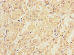 Invitrogen PMM2 Polyclonal Antibody 100 &mu;L; Unconjugated:Antibodies,