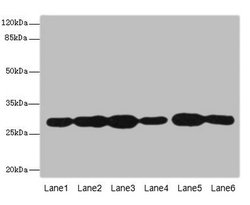 Invitrogen PMM2 Polyclonal Antibody 100 &mu;L; Unconjugated:Antibodies,