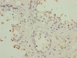 Invitrogen PMPCB Polyclonal Antibody 100 &mu;L; Unconjugated:Antibodies,
