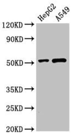 Invitrogen PNLIPRP2 Polyclonal Antibody 100 &mu;g; Unconjugated:Antibodies,