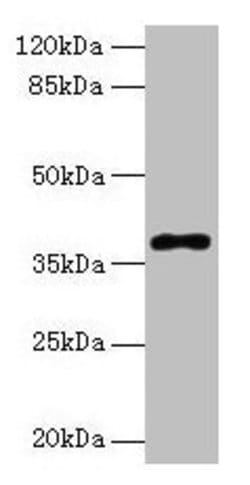 Invitrogen POLB Polyclonal Antibody 100 &mu;g; Unconjugated:Antibodies,