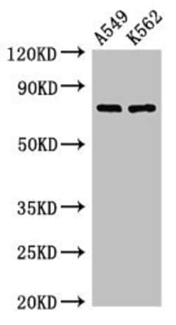 Invitrogen POLH Polyclonal Antibody 100 &mu;g | Buy Online | Invitrogen&trade; | Fisher Scientific