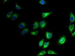 Invitrogen PPAP2C Polyclonal Antibody 100 &mu;g; Unconjugated:Antibodies,