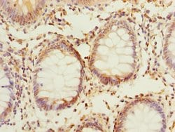 Invitrogen PPAP2C Polyclonal Antibody 100 &mu;g; Unconjugated:Antibodies,