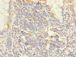 Invitrogen PPAP2C Polyclonal Antibody 100 &mu;g; Unconjugated:Antibodies,