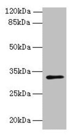 Invitrogen PPAP2C Polyclonal Antibody 100 &mu;g; Unconjugated:Antibodies,