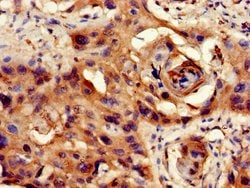 Invitrogen PP1 beta Polyclonal Antibody 100 &mu;g; Unconjugated:Antibodies,