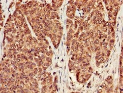 Invitrogen PP1 beta Polyclonal Antibody 100 &mu;g; Unconjugated:Antibodies,