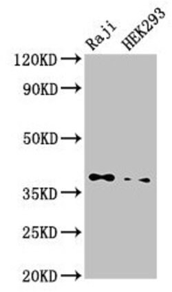 Invitrogen PP1 beta Polyclonal Antibody 100 &mu;g; Unconjugated:Antibodies,
