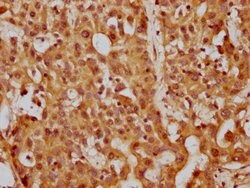 Invitrogen PP5 Polyclonal Antibody 100 &mu;L; Unconjugated:Antibodies,