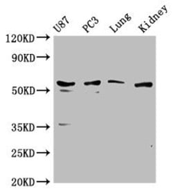 Invitrogen PP5 Polyclonal Antibody 100 &mu;L; Unconjugated:Antibodies,
