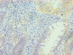 Invitrogen PRDX5 Polyclonal Antibody 100 &mu;L; Unconjugated:Antibodies,