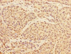Invitrogen PRPF4 Polyclonal Antibody 100 &mu;L; Unconjugated:Antibodies,