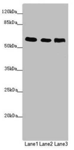 Invitrogen PRPF4 Polyclonal Antibody 100 &mu;L; Unconjugated:Antibodies,