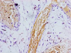Invitrogen Presenilin 1 Polyclonal Antibody 100 &mu;L; Unconjugated:Antibodies,