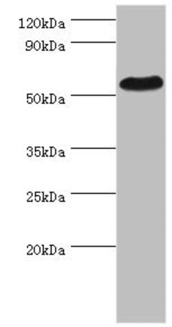 Invitrogen Presenilin 1 Polyclonal Antibody 100 &mu;L; Unconjugated:Antibodies,