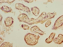 Invitrogen PSMB3 Polyclonal Antibody 100 &mu;L | Buy Online | Invitrogen&trade; | Fisher Scientific