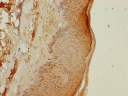 Invitrogen PSMB3 Polyclonal Antibody 100 &mu;L | Buy Online | Invitrogen&trade; | Fisher Scientific